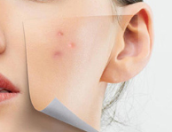 藥用壬二酸用于皮膚護(hù)理 - 拯救干燥肌膚的靈丹妙藥！